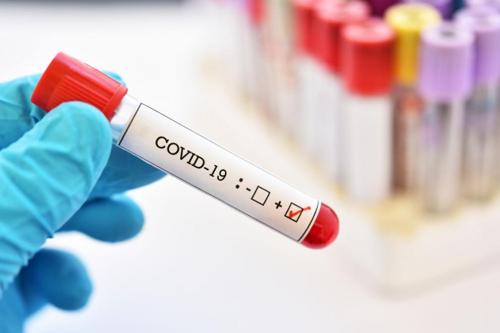 Изследване за наличие на антитела за COVID-19 по ELISA метод в ДКЦ Пълмед