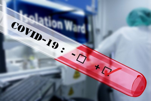 Пробовземане за PCR тест в Пълмед и в празничния 7-ми септември