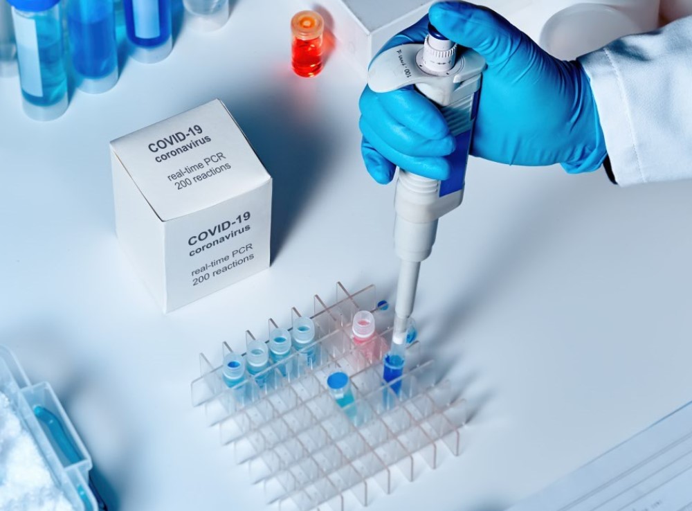  ДКЦ „Пълмед“ с преференциални цени за PCR тестове за ковид и Т-клетъчен имунитет срещу SARS-COV-2 през летния сезон