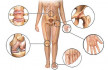 Безплатни прегледи за определяне на риска от остеопороза в ДКЦ „Пълмед“
