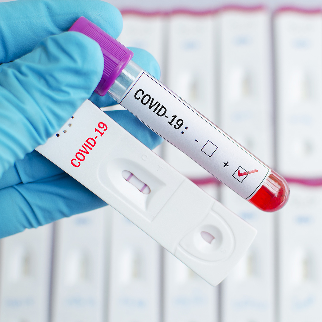 Бързи тестове за антигенни  и антитела за коронавирус