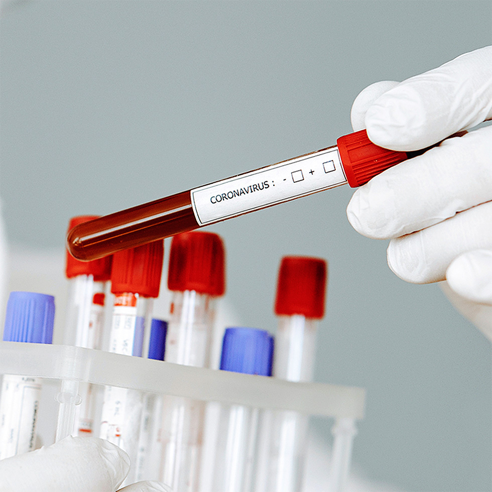 Количествен и качествен тест за антитела